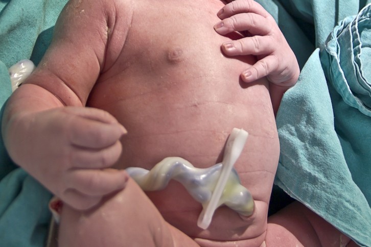 What can you do with an umbilical cord? - BBC News